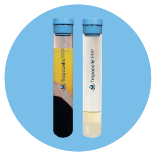 Plasma Rico en Plaquetas